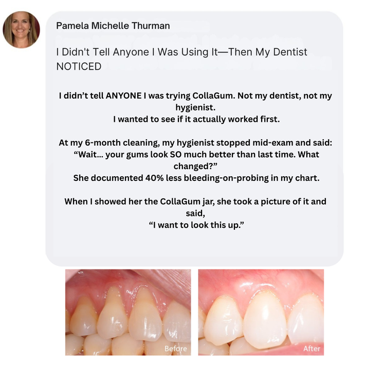 Customer gum-care experience